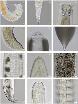 Phylogenomic Analysis of the Phylum Nematoda: Conflicts and Congruences With Morphology, 18S rRNA, and Mitogenomes